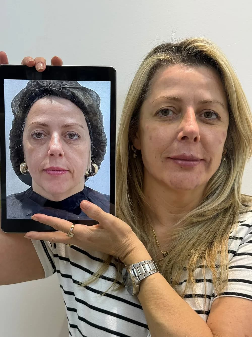 Paciente 1 segurando um tablet com a foto de antes do procedimento